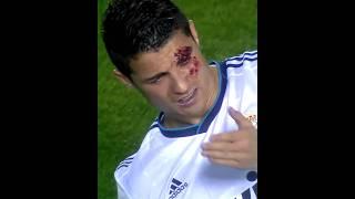When Players Get Hurt + Ronaldo 