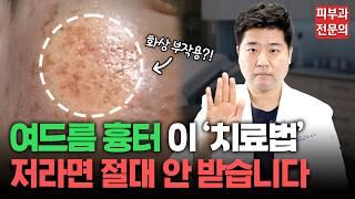 피부과 전문의가 공개하는 절대 추천하지 않는 흉터 치료법!ㅣ나에게 맞는 여드름 흉터 치료 제대로 알고 고르세요!