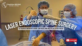 2-level Laser Endoscopic Spine Surgery