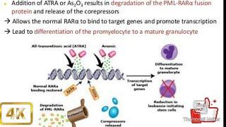 Differentiation Syndrome pathophysiology