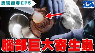 開腦取出巨大寄生蟲囊腫 畫面驚呆了 | 良醫墨非/天才肖恩S1EP5 | 蒼藍鴿評評理EP75