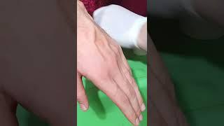 How to Insert IV Cannula | IV Cannulation Technique | Branula | Intravenous Catheter