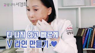 티 나지 않고 빠르게 V라인 만들기  [감성닥터 서경희의 셀프(SELF) 시술]