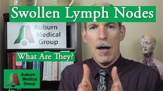 Swollen Lymph Nodes | Auburn Medical Group