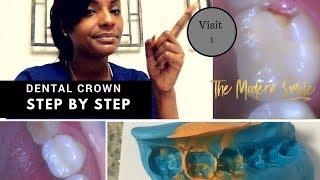 Dental Crown step by step | photos with explanation