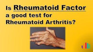 Is Rheumatoid Factor a Good Test for Rheumatoid Arthritis?