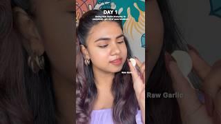 Fighting Acne with Garlic Day 1 Update #ytshorts #garlic #acne