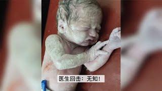 刚出生的宝宝被护士按住搓，爸爸怒了，医生回击：无知