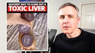 Akka Liver Supplement Reviews, Dr. Gina Sam and Enclave BioActives, Explained