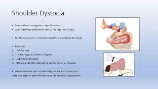 Shoulder Dystocia