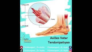 Fizioterapevt Dr Aydın Mikayıllı +994 51 517 33 63Life Center Saray