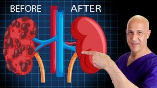 How to Heal & Cleanse Your KIDNEYS!  Dr. Mandell