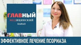 Лечение псориаза в домашних условиях. Народные средства от псориаза. Как вылечить псориаз