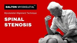 Understanding Bilateral Sciatica & Lumbar Stenosis: Erik Dalton Explains Causes & Treatment Options