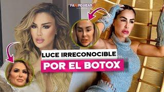 NINEL CONDE LUCE IRRECONOCIBLE POR EL BOTOX.