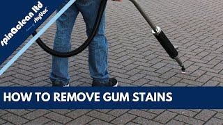 Gum Ranger Freestyle: Extremely Rapid and Reliable Chewing Gum Removal System