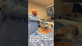 Robotic Spine Surgery: demonstration of placing a screw! #roboticspinesurgery #spine #spinesurgeon