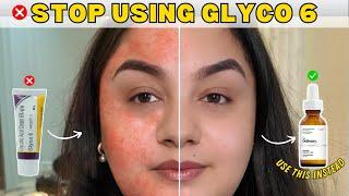 Is Glycolic Acid Right For You? SAFE  Alternatives to Try Instead!