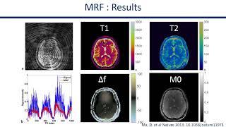 ISMRM MR Academy - MR Fingerprinting