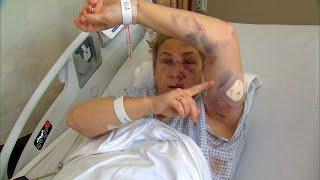 Woman Survives Mama Bear Attack