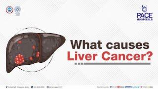 What are the causes of Liver Cancer? | PACE Hospitals #shortvideo