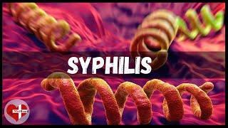 What is Syphilis? | Syphilis treatment, causes and symptoms Made Astoundingly Easy