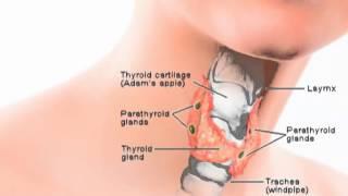 HIJAMA FOR THE TREATMENT OF THYROID/2 (5)