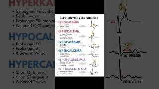 notes of electrolytes and EKG  change #nurse #notes #ekg