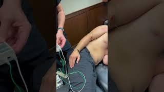 Tennis Elbow Treatment by radial nerve stimulation