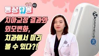 치아교정 전후, 치과에서 미리보기 가능? 치아교정 과정 총정리!