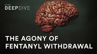 Why fentanyl withdrawal is so unbearable