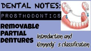 STUDY WITH ME I DENTAL NOTES I REMOVABLE PARTIAL DENTURE I KENNEDY'S CLASSIFICATION AND INTRODUCTION