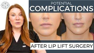 Potential Lip Lift Complications