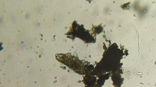 Tardigrades the cute little creatures but it can survive anything..By Anmol Samsuhang