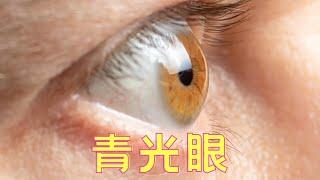 青光眼：眼睛的疾病 | Glaucoma： Eyes illness