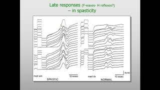 F-Wave, A-Reflex and H-Reflex Lecure