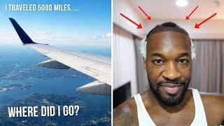 I Traveled 5,000 Miles for a Hair Transplant | I AM RIO P.