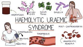 Haemolytic Uraemic Syndrome