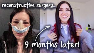 I got major surgery... 9 month update and Q&A || Kelli Marissa Vlogs