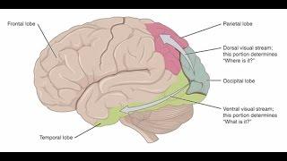 Cerebral Visual Impairment: A Brain-Based Visual Condition