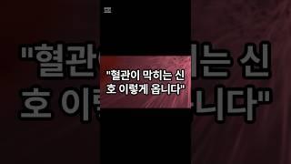 혈관이 막히고 있다는 3가지 신호