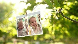 Baby Grayson Receives Life-Saving Surgery