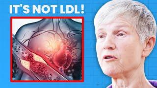 The REAL Drivers of Heart Disease (Not High Cholesterol) | Dr. Sarah Myhill