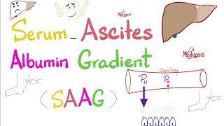 Serum Ascites Albumin Gradient (SAAG) | Peritoneal Effusion | Lab 