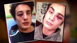 Teen's Face Smashed - Tucson's Most Wanted