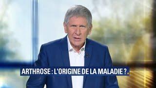 Arthrose: connaissez-vous l’origine de la maladie ?