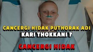 Cancergi Hidak Puthorak adi Kari Thokkani ?