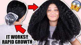 Baggy method for FAST HAIR GROWTH! No more dry ends  Retain length & reduce breakage