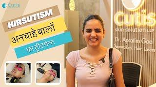 Hirsutism - Causes, Symptoms, and Treatment | Rashmeet Kaur Sethi | Cutis Skin Solution