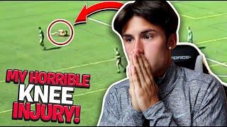 REACTING TO MY HORRIBLE KNEE INJURY...(2 YEARS LATER) | Footballer ACL Rupture